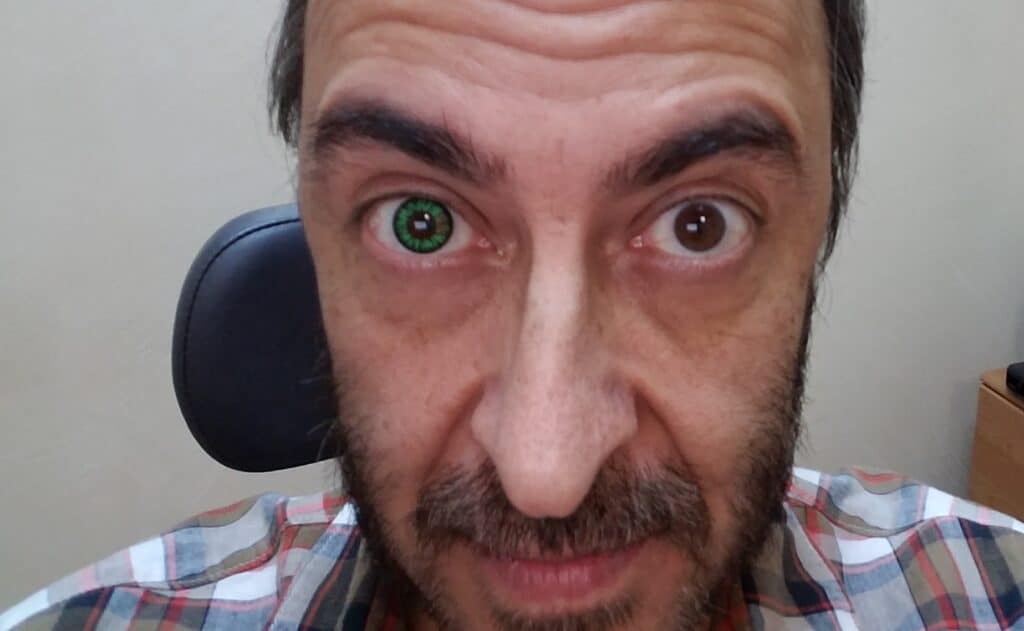 Celebrity Wearing Contact Lens In One Eye.